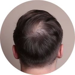 Hair